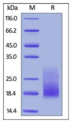 Cynomolgus/Rhesus macaque TIGIT, His Tag (HPLC-verified) on SDS-PAGE under reducing (R) condition. The gel was stained overnight with Coomassie Blue. The purity of the protein is greater than 90%.